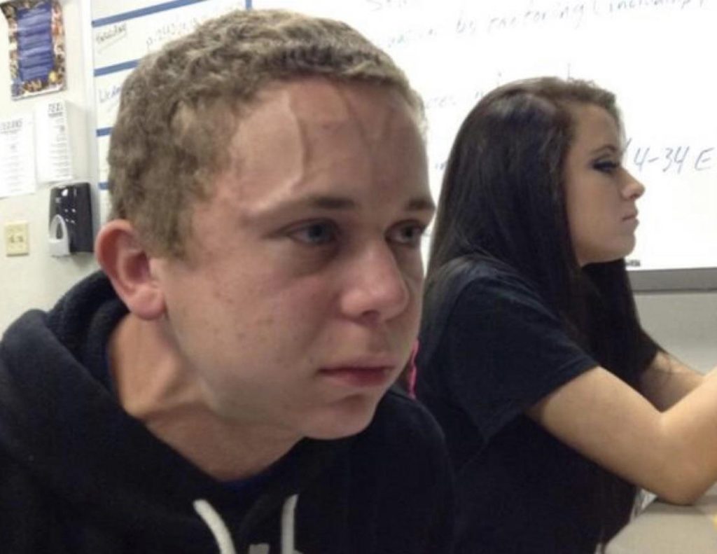 20 Vein Forehead Guy Meme Templates to Express Any Struggle